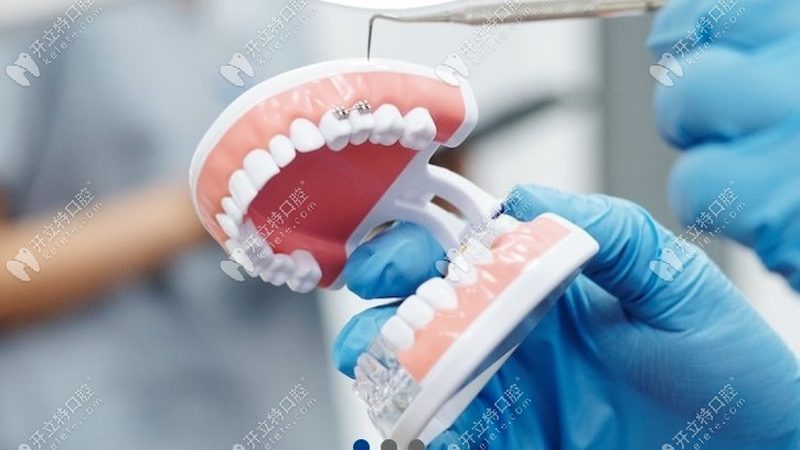 牙科诊所洗牙安全吗？揭秘洗牙的真相与误区